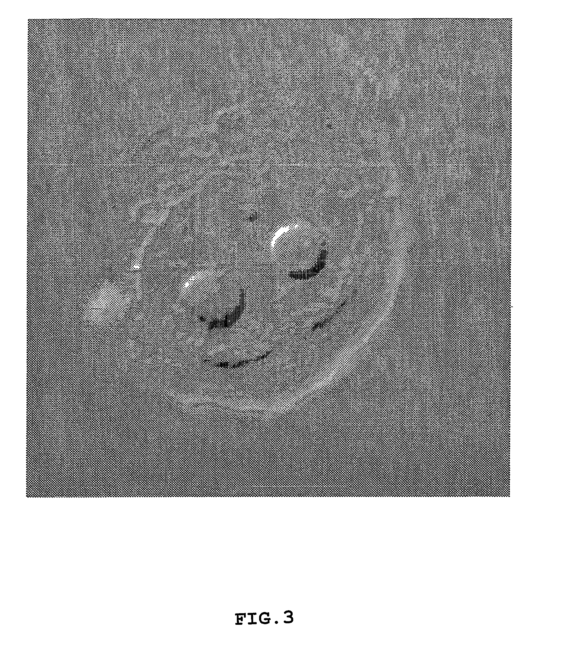 Lipidated glycoprotein particles and methods of use