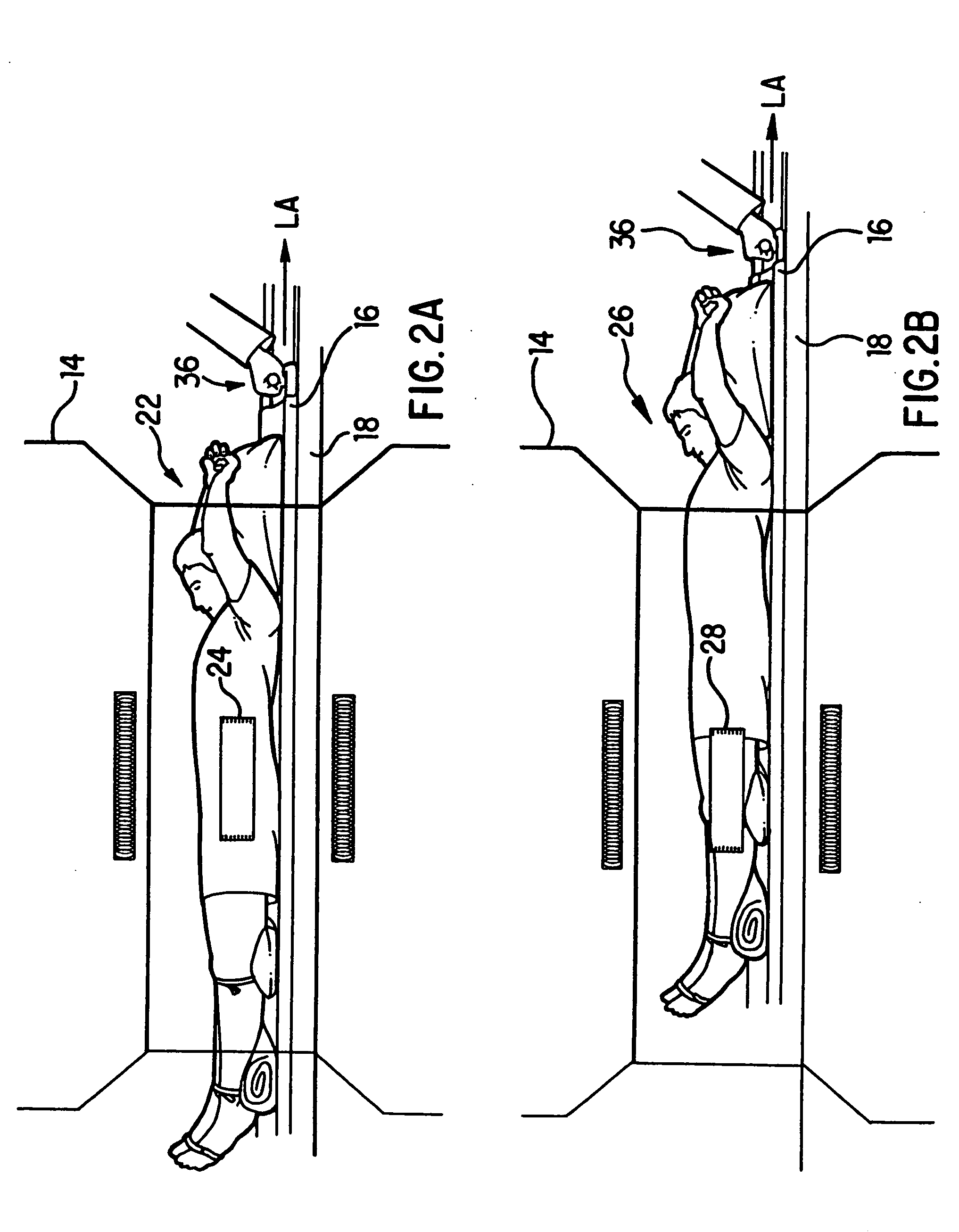 Method and apparatus for magnetic resonance arteriography using contrast agents