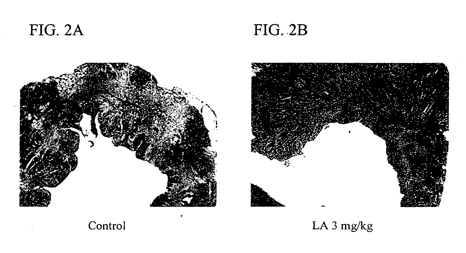 Method of treating ischemia-reperfusion injury