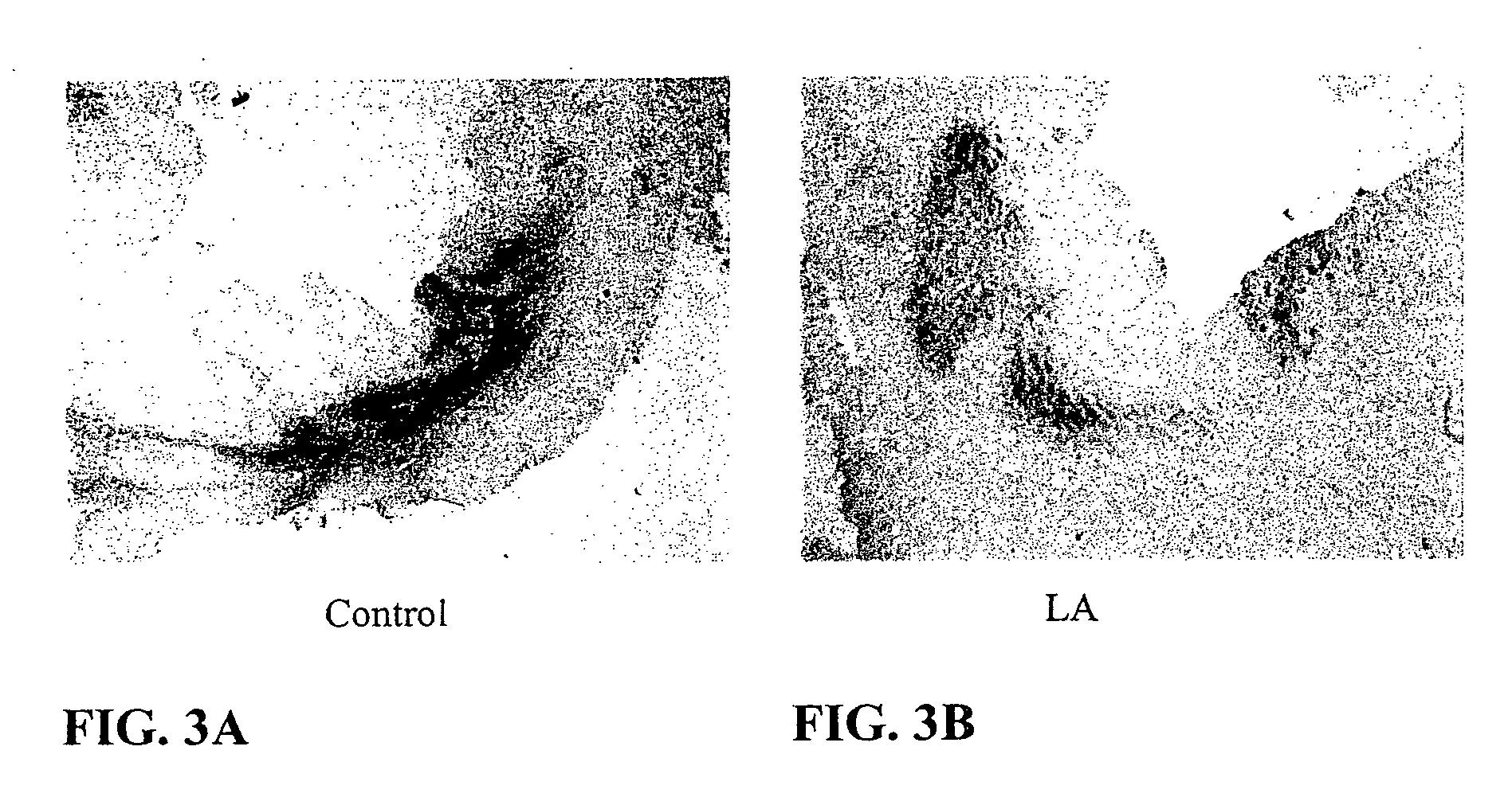 Method of treating ischemia-reperfusion injury