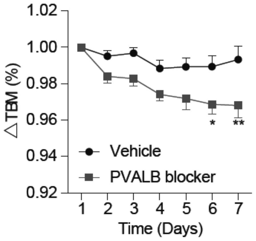 Application of inhibitor of parvalbumin in preparation of product for preventing and treating obesity and diseases caused by obesity