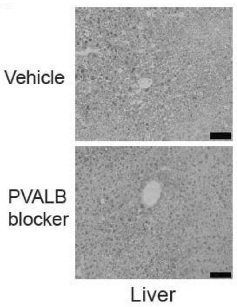 Application of inhibitor of parvalbumin in preparation of product for preventing and treating obesity and diseases caused by obesity