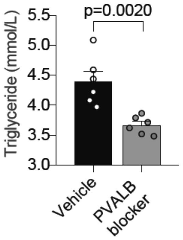 Application of inhibitor of parvalbumin in preparation of product for preventing and treating obesity and diseases caused by obesity