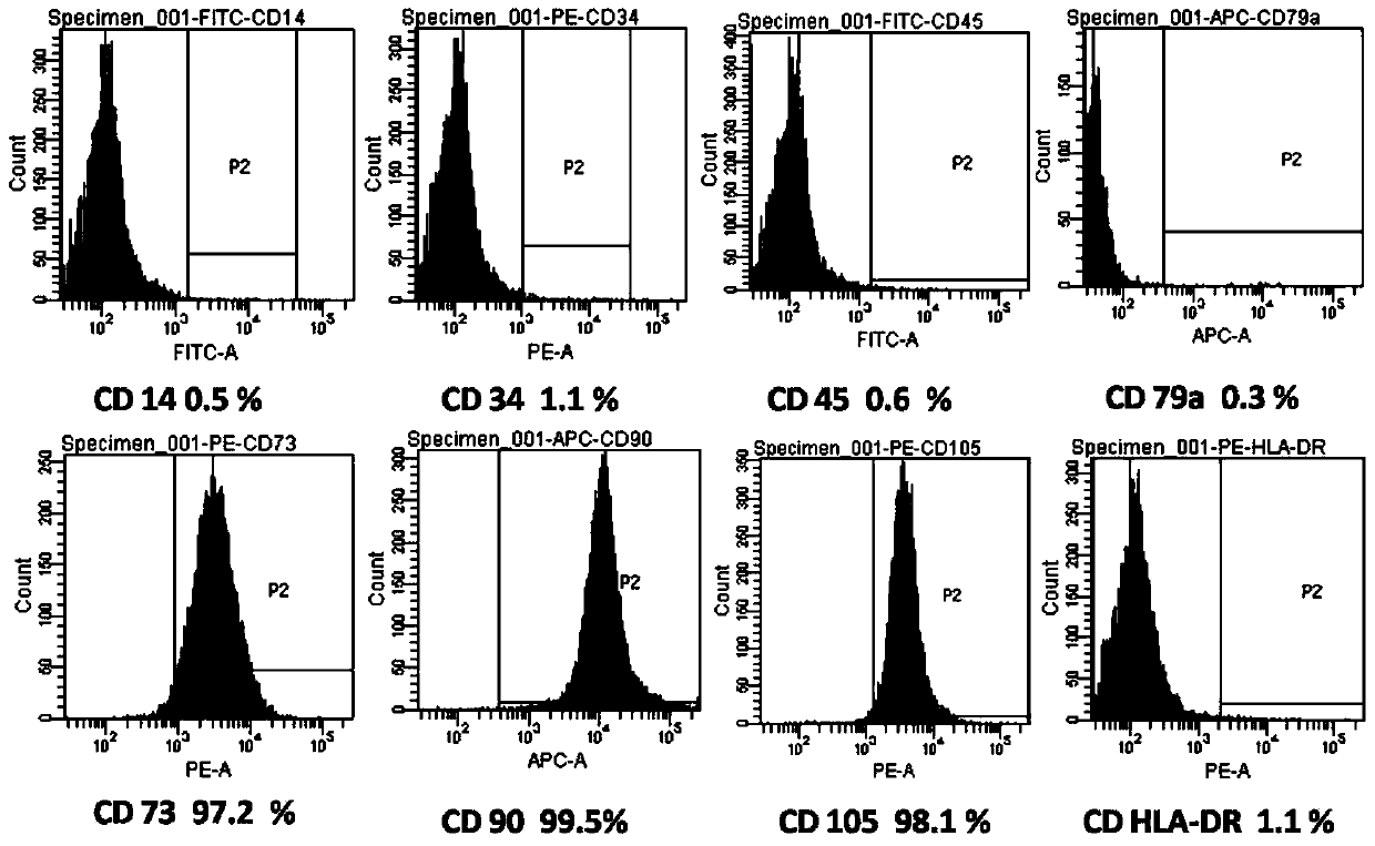 A method for preparing chorionic mesenchymal stem cells