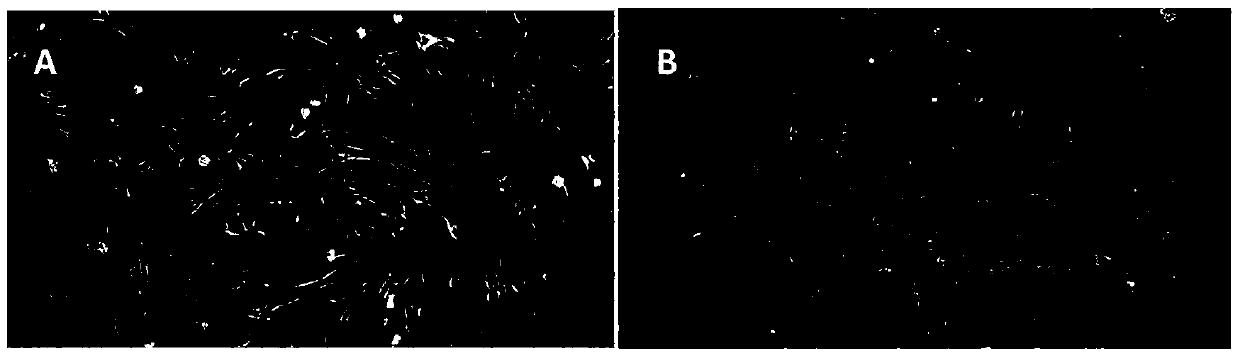 A method for preparing chorionic mesenchymal stem cells