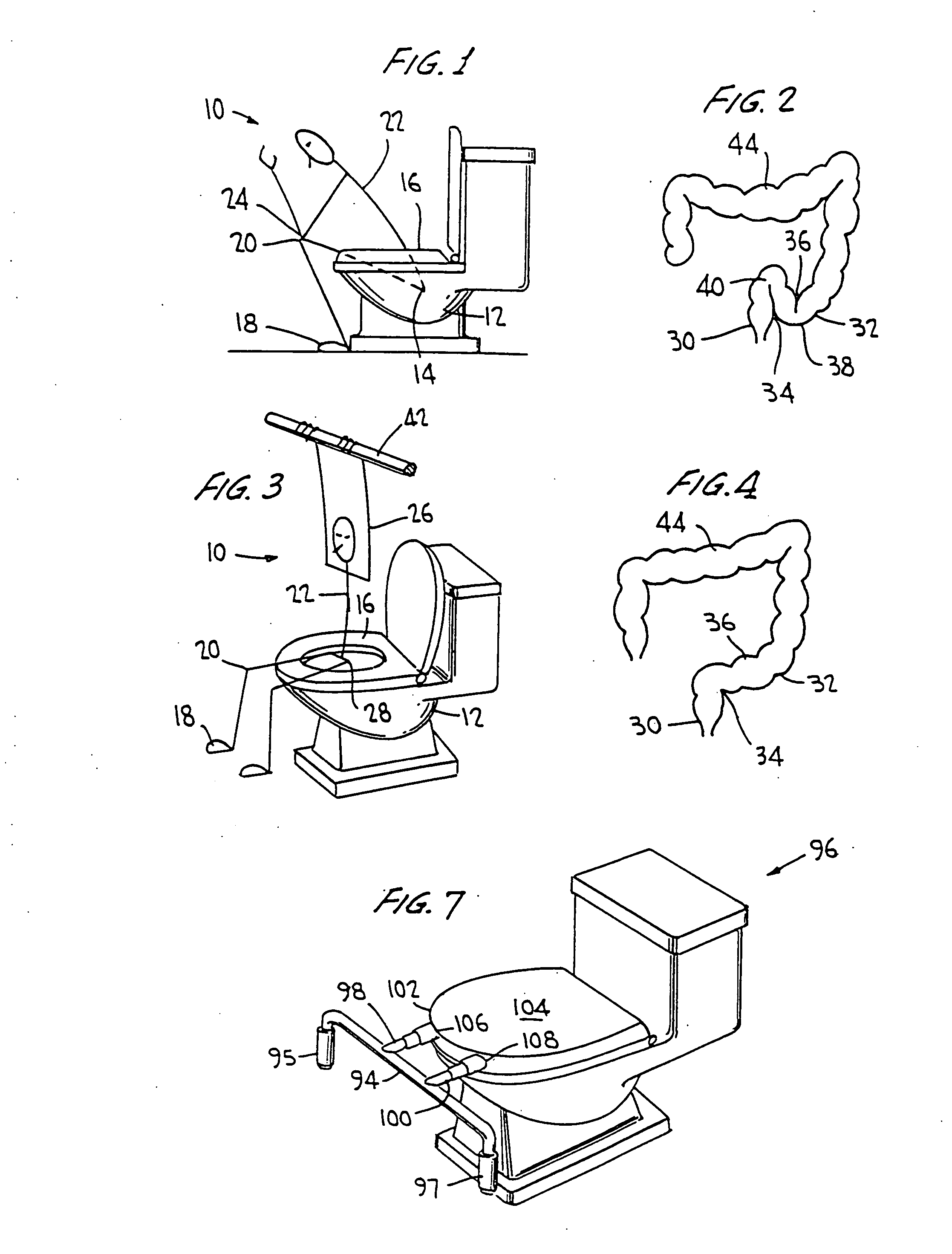 Anti-constipation method and device