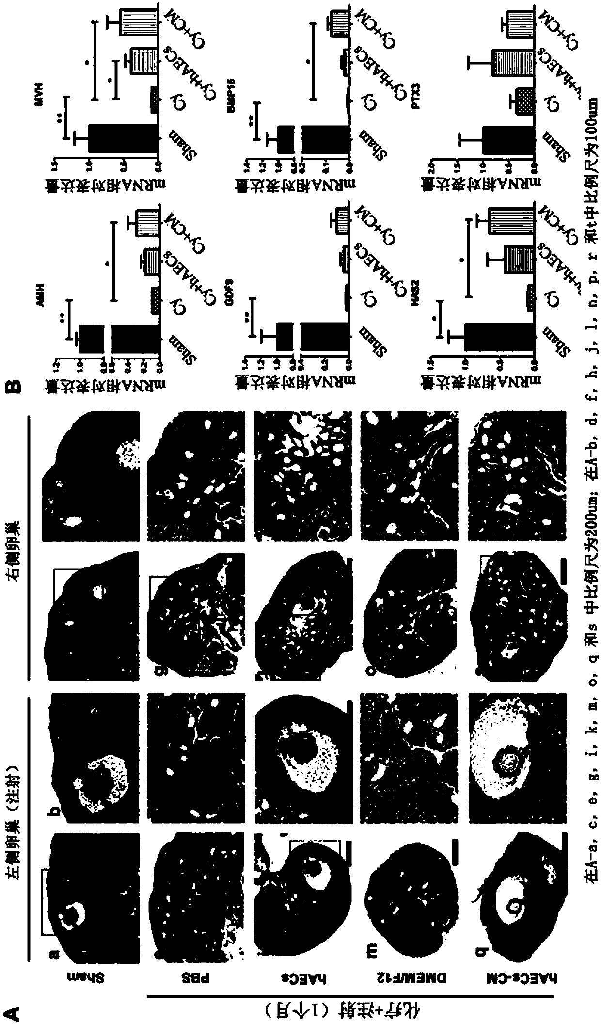 Application of human amniotic epithelial cell secretory factor in preparation of medicine for ovarian function restoration