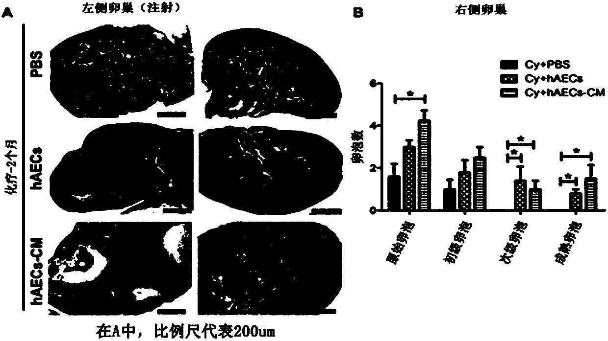 Application of human amniotic epithelial cell secretory factor in preparation of medicine for ovarian function restoration