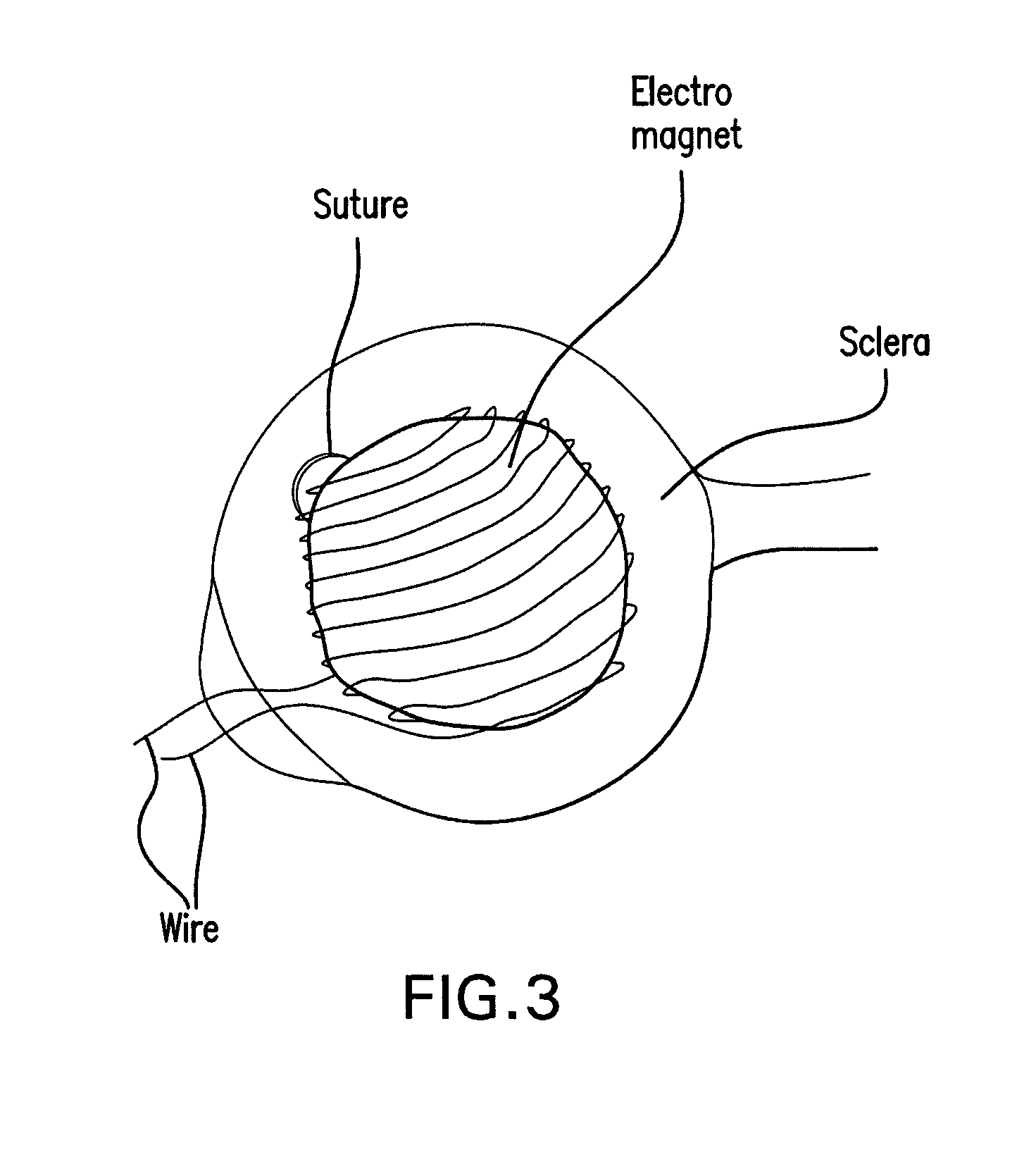 Method and composition for hyperthermally treating cells