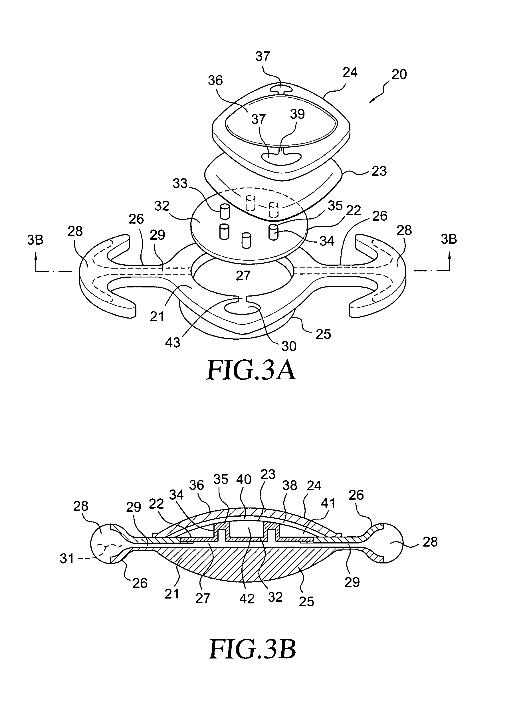 Accommodating intraocular lens having peripherally actuated deflectable surface and method