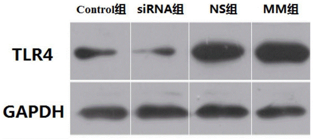 A small RNA interfering with TLR4 receptor and its application