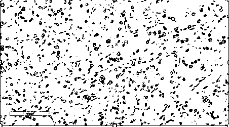 Detection reagent containing phosphoglucomutase 5-antibody and application of detection reagent