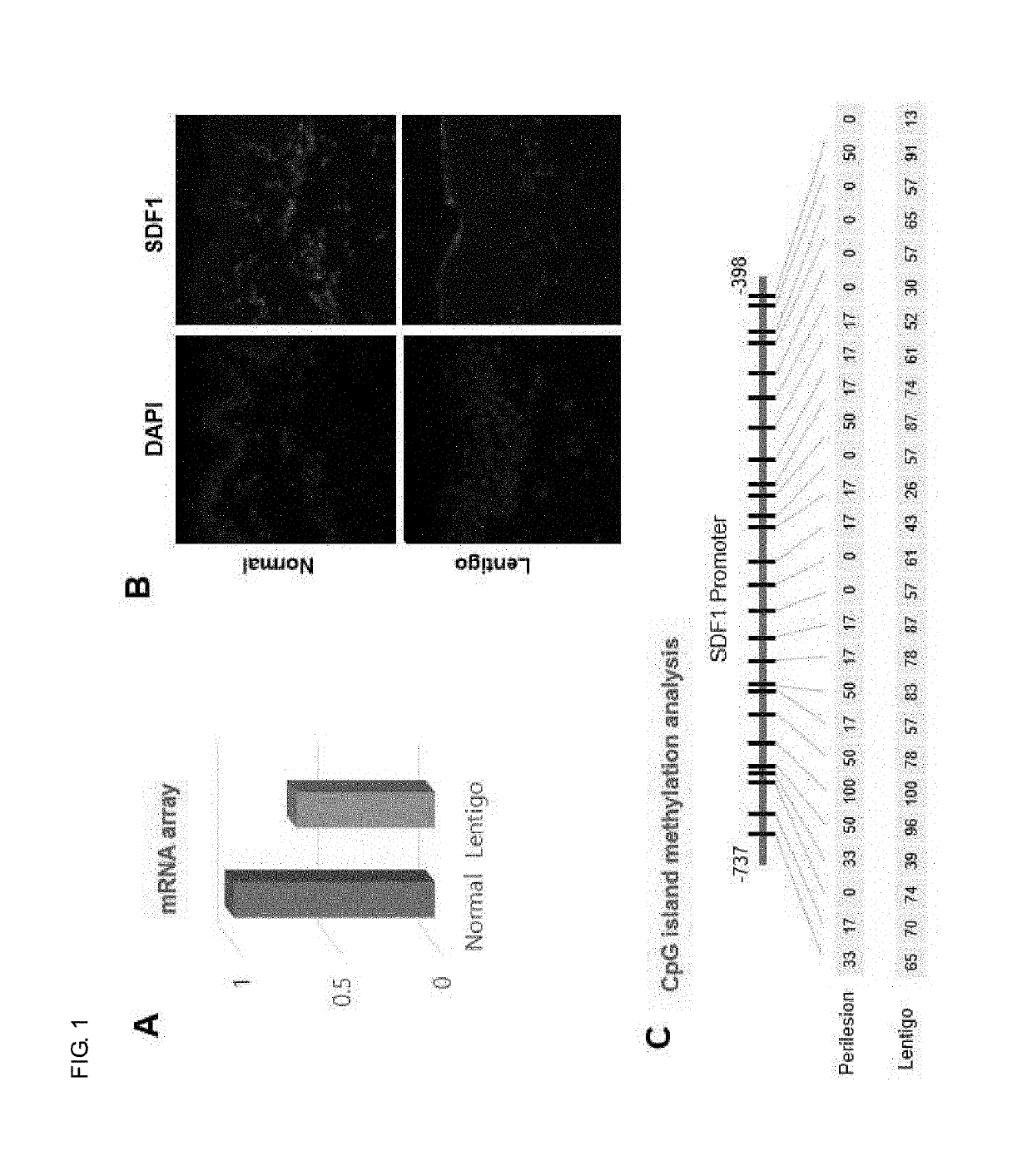 Composition for regulating cutaneous pigmentation or skin whitening comprising sdf1