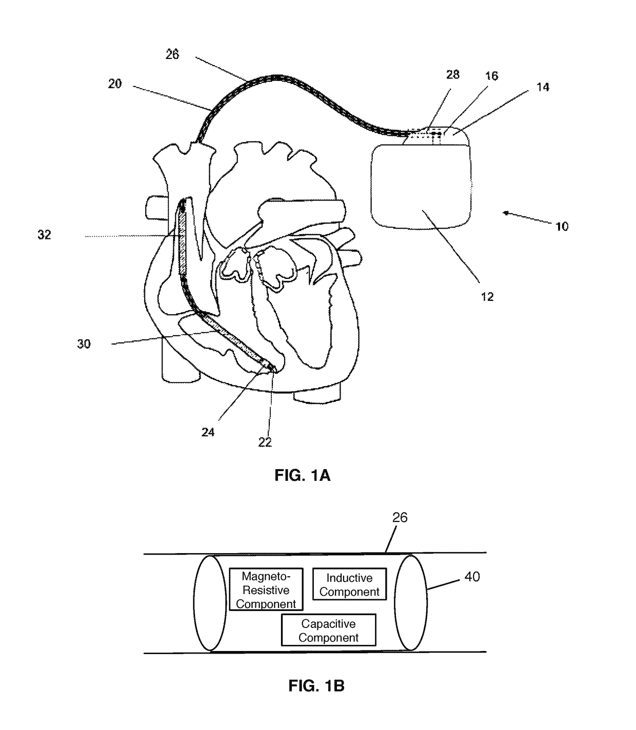 Implantable device with electrical filter