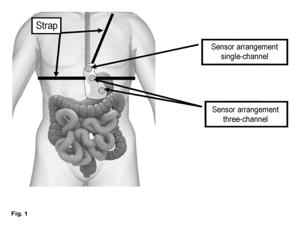 Personalized detection system for detecting magnetic objects in the human organism