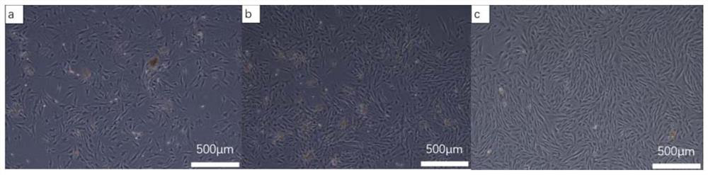 Construction method of immortalized feeder layer cell strain, immortalized feeder layer cell strain and application