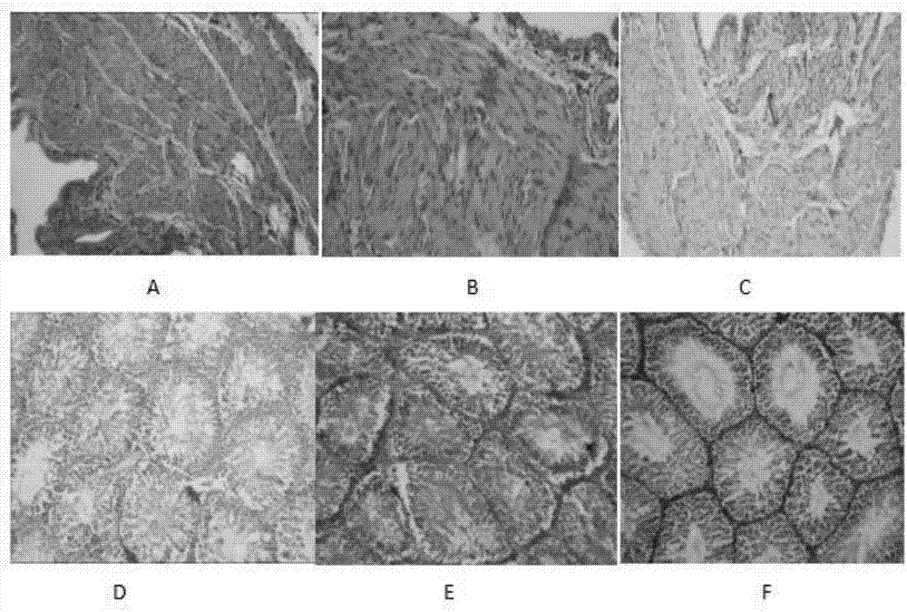 Veterinary-use radix daphniphylli calycini and red-knees herb granule and application thereof to chicken necrotic enteritis