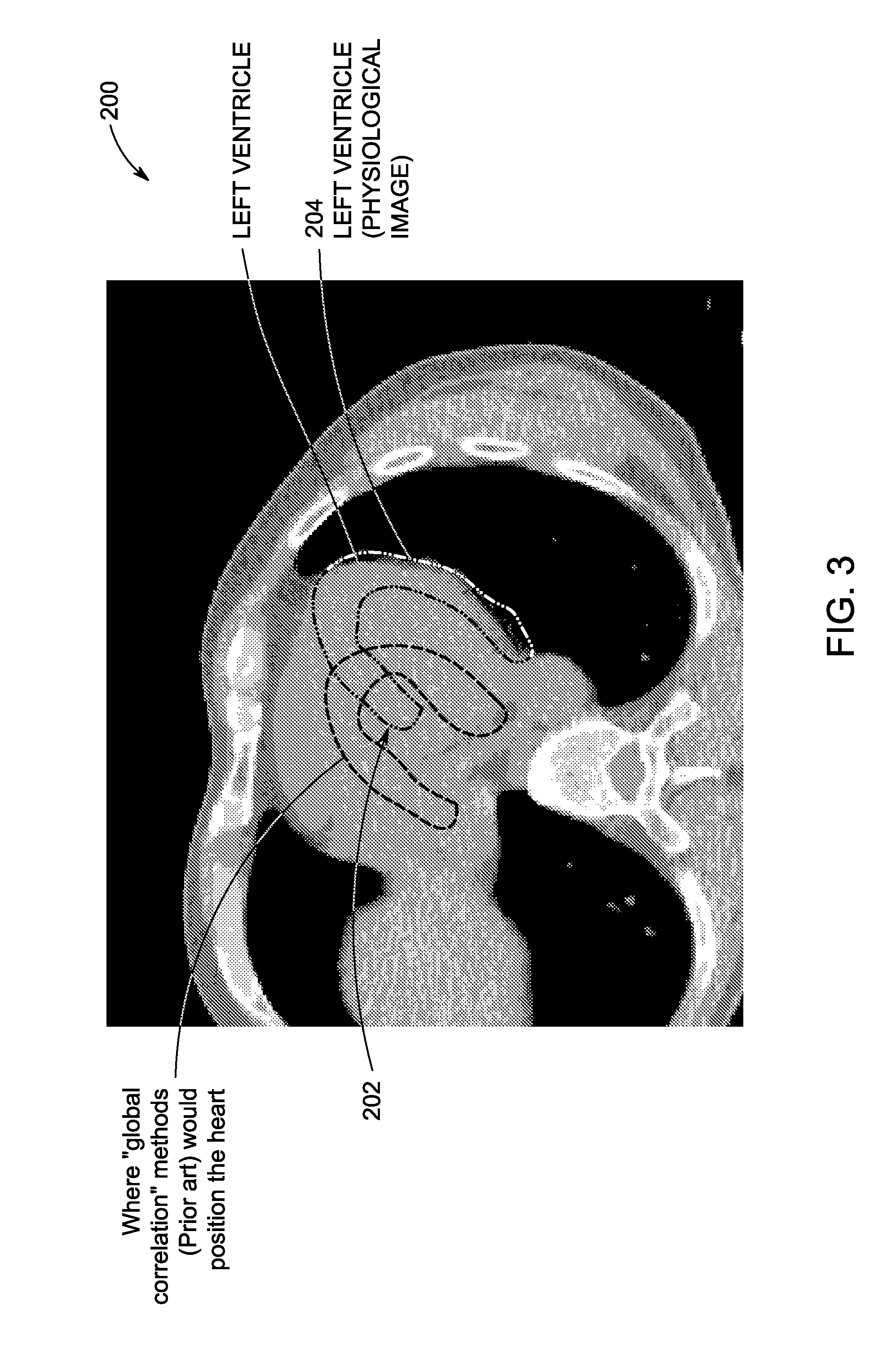 Method and apparatus for automatically registering images