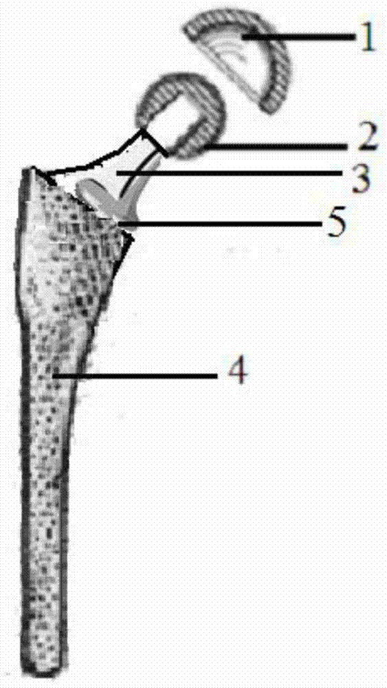 A kind of hip joint prosthesis and preparation method thereof