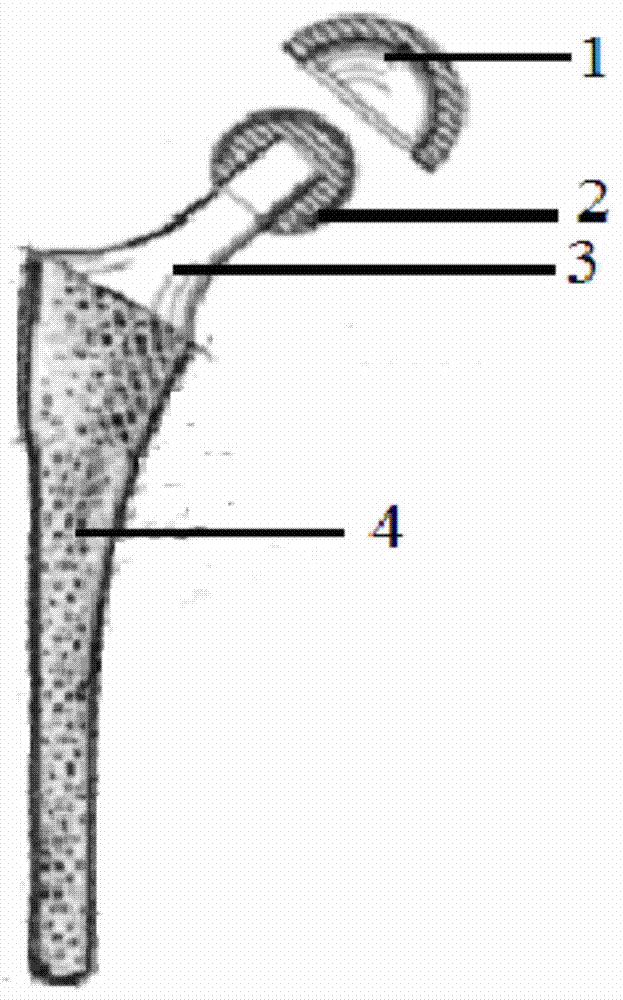 A kind of hip joint prosthesis and preparation method thereof