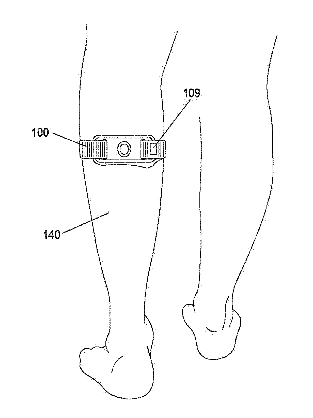 Dynamic control of transcutaneous electrical nerve stimulation therapy using continuous sleep detection