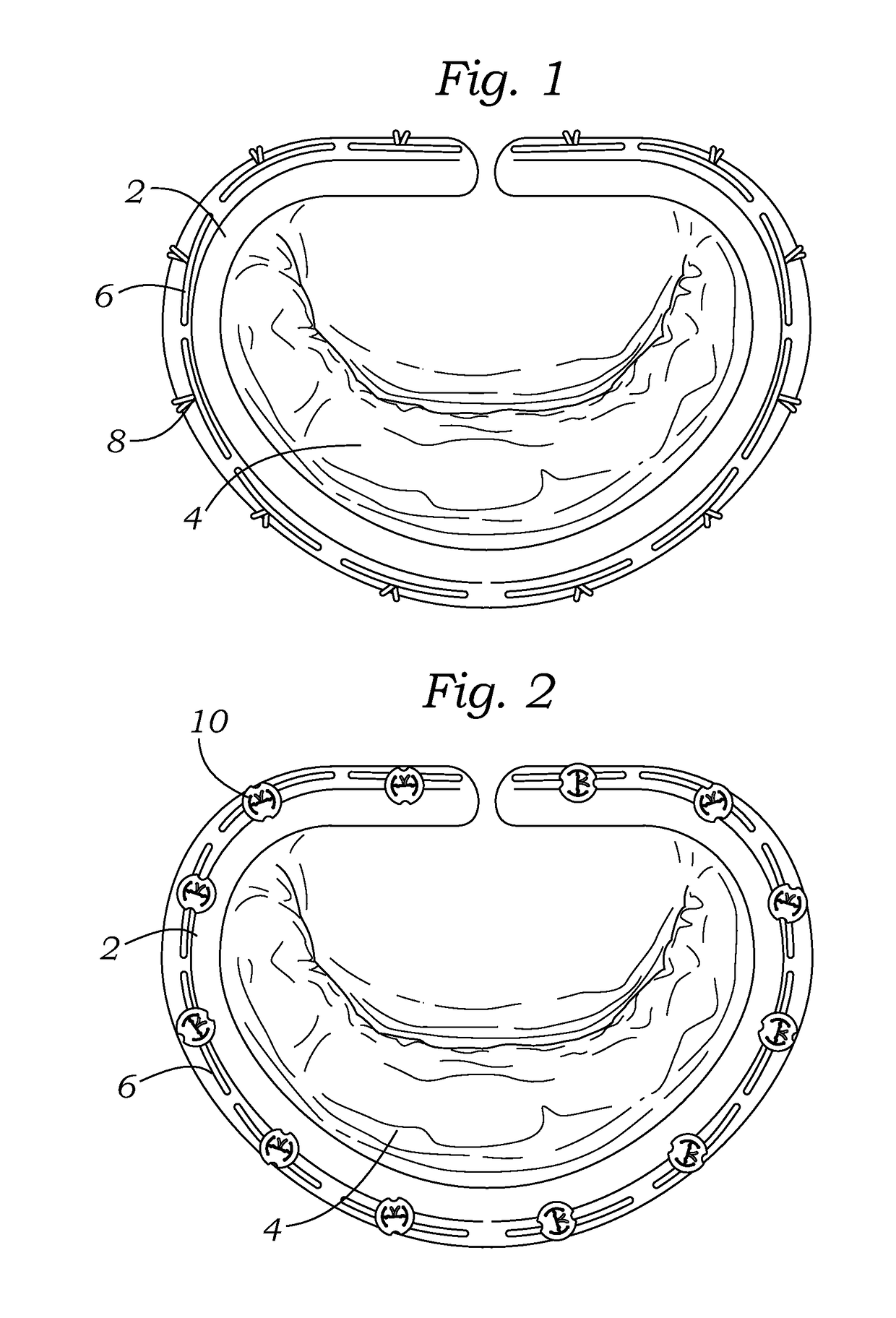 Knotless suture fastener installation system