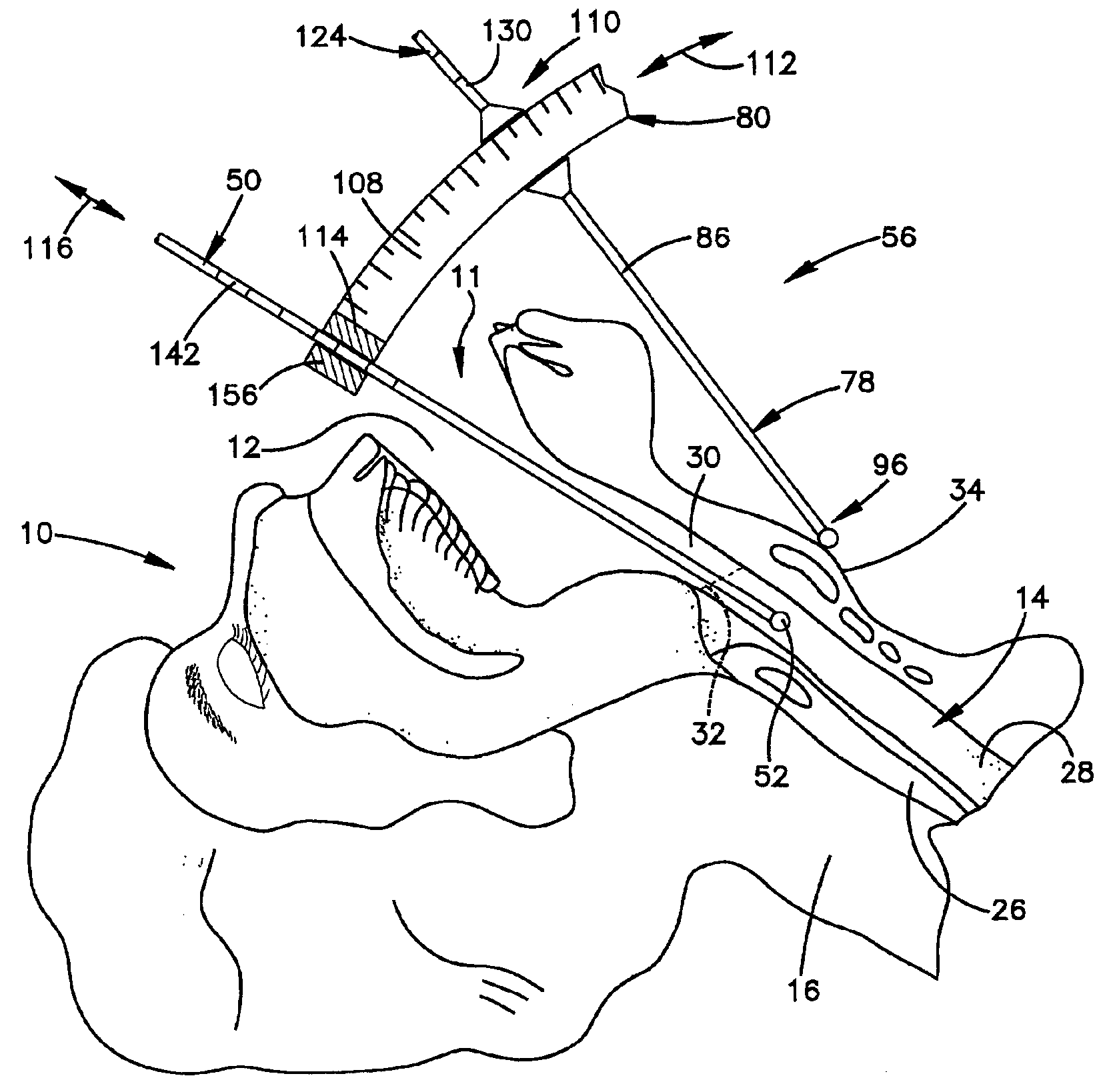 Medicant delivery system and method