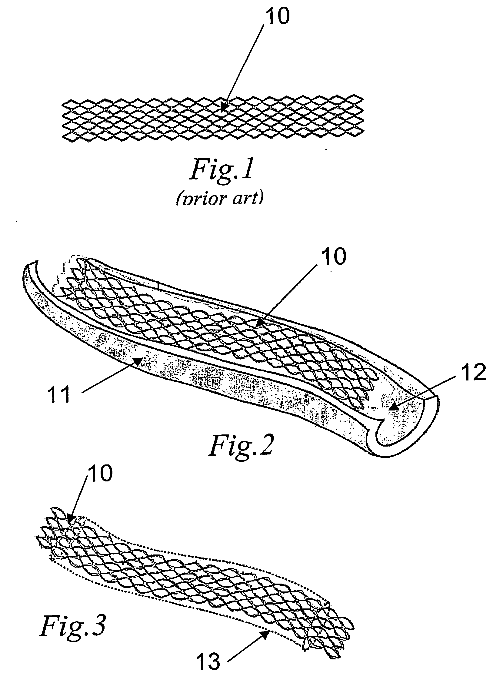 Endoprosthesis process to obtain and methods used
