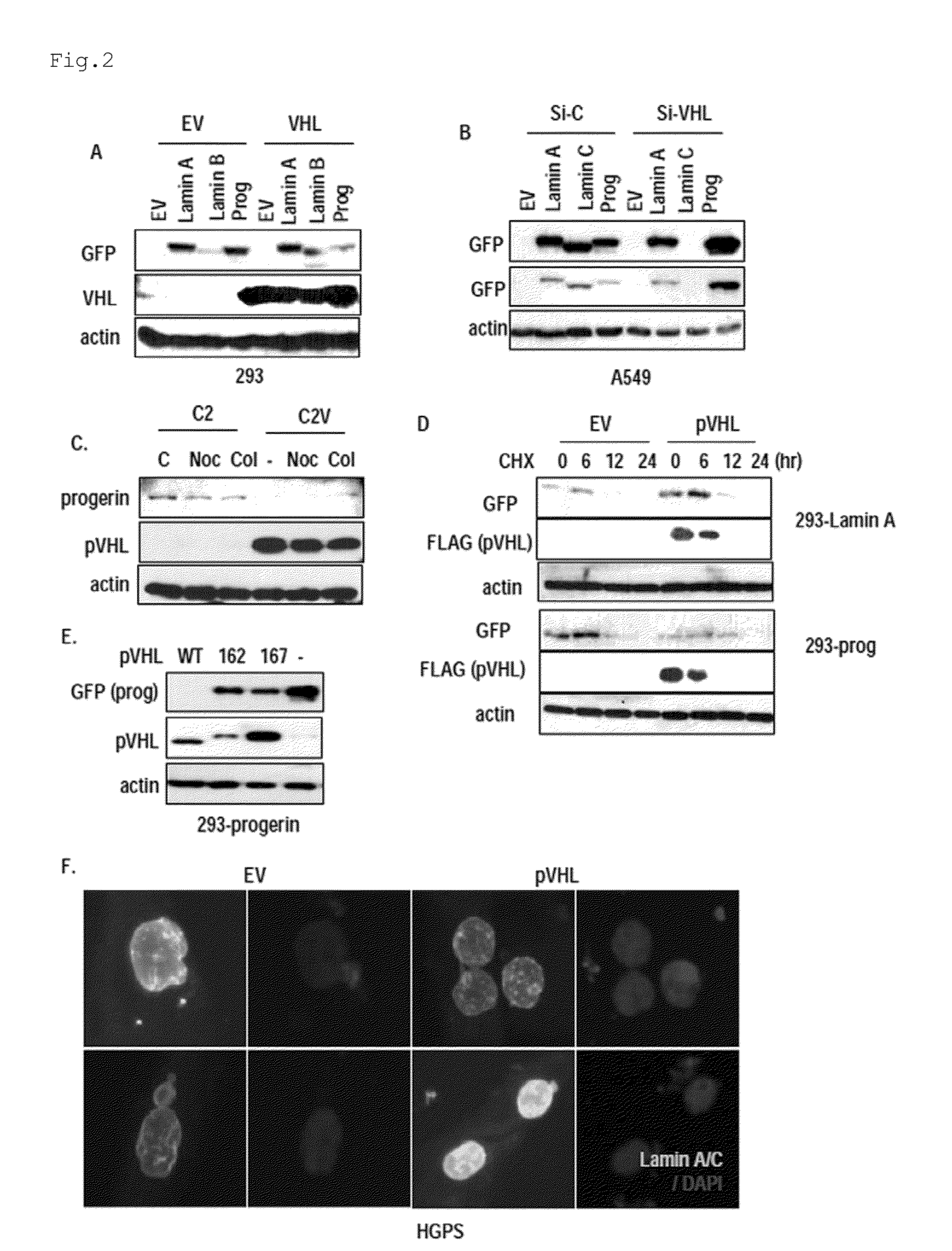 Pharmaceutical composition for treating aging-associated diseases, containing progerin expression inhibitor as active ingredient, and screening method of said progerin expression inhibitor