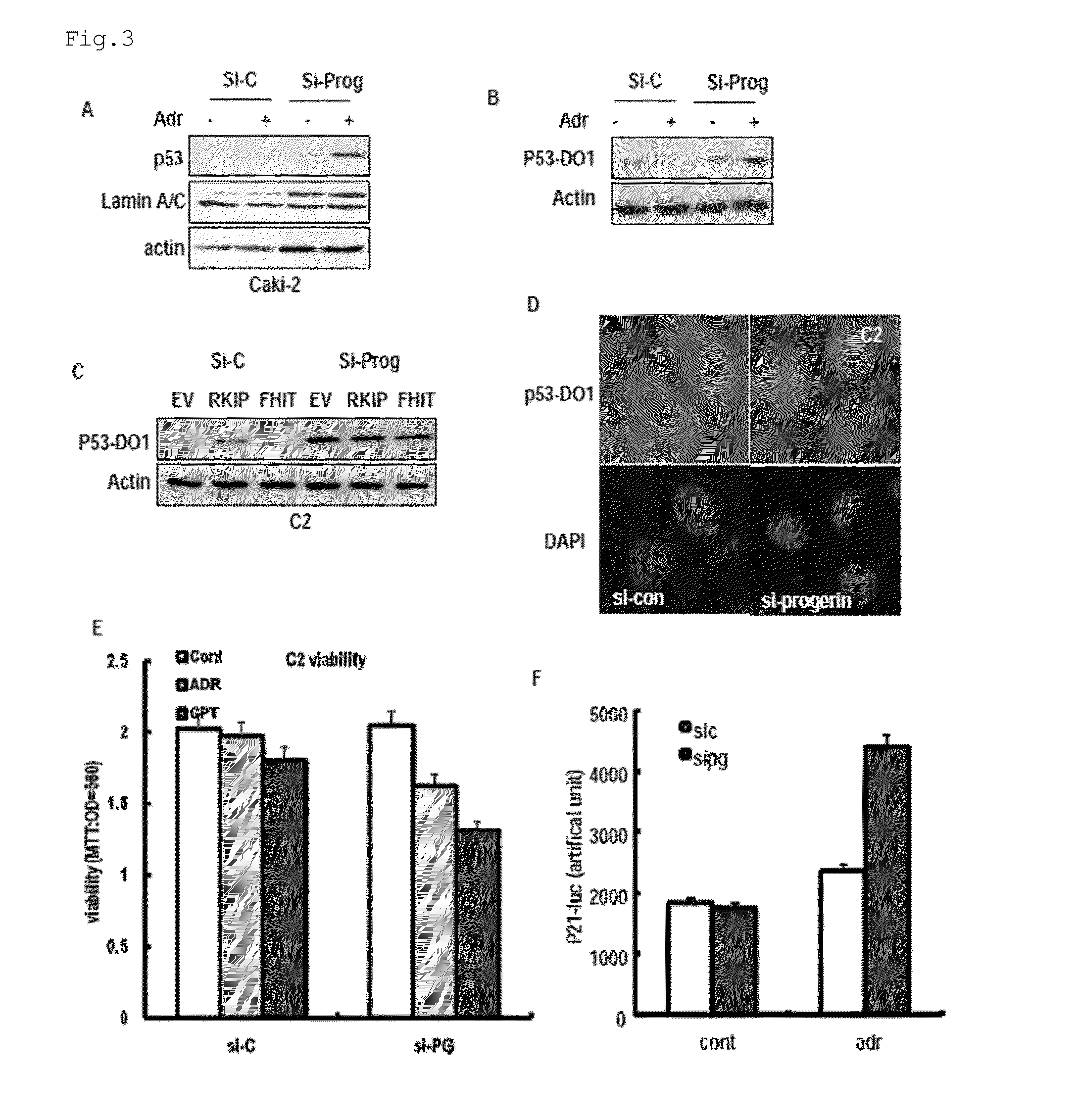 Pharmaceutical composition for treating aging-associated diseases, containing progerin expression inhibitor as active ingredient, and screening method of said progerin expression inhibitor