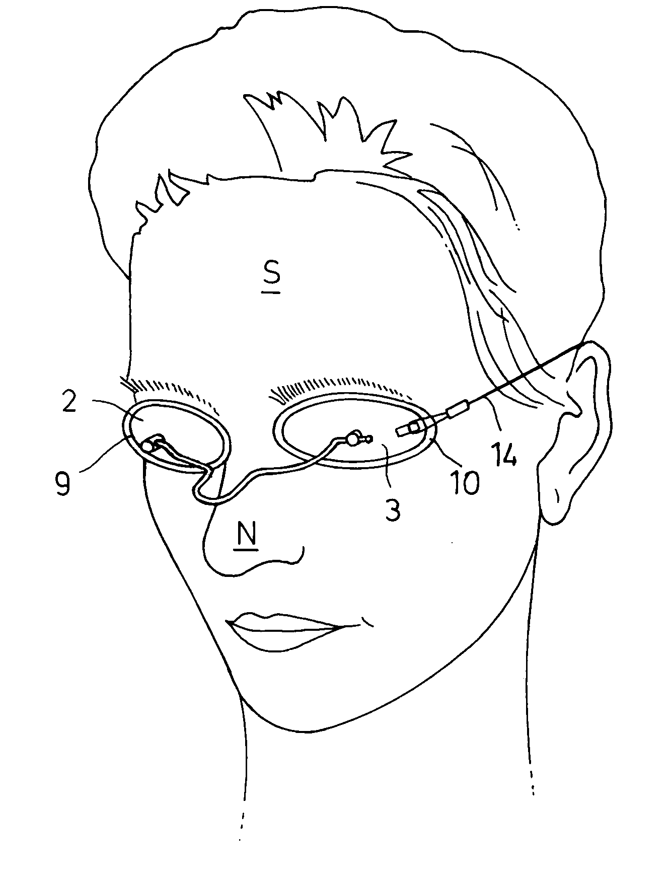 Eye protection device, particularly against laser beams and high-intensity light beams