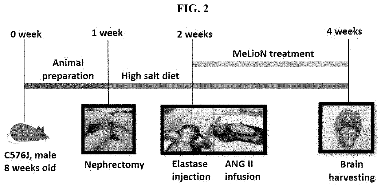 Composition for preventing, ameliorating, or treating cerebrovascular disease comprising melittin or magnetic iron oxide nanoparticle loaded with melittin as effective component