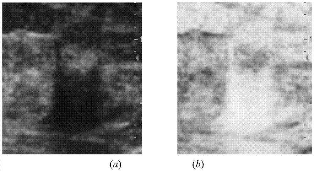 A breast tumor ultrasound image segmentation method based on improved level set algorithm