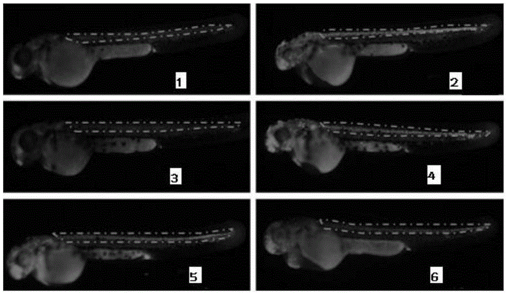 Application of Ruyizhenbao preparation in preparing medicine for nerve injury protection and regeneration