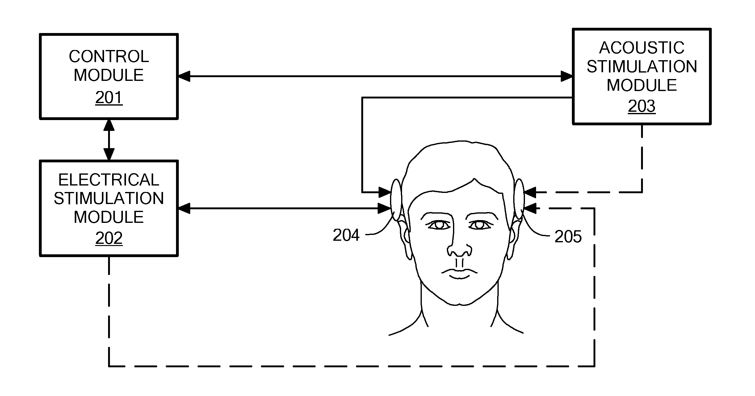 Fitting Unilateral Electric Acoustic Stimulation for Binaural Hearing