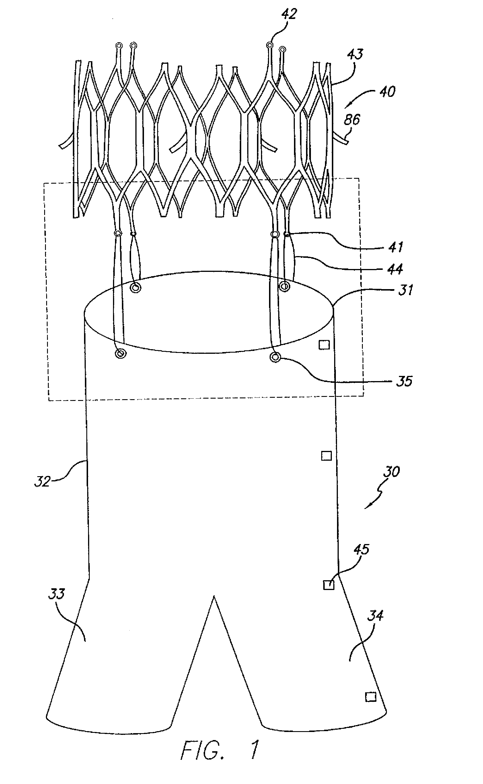 Endovascular graft device and methods for attaching components thereof
