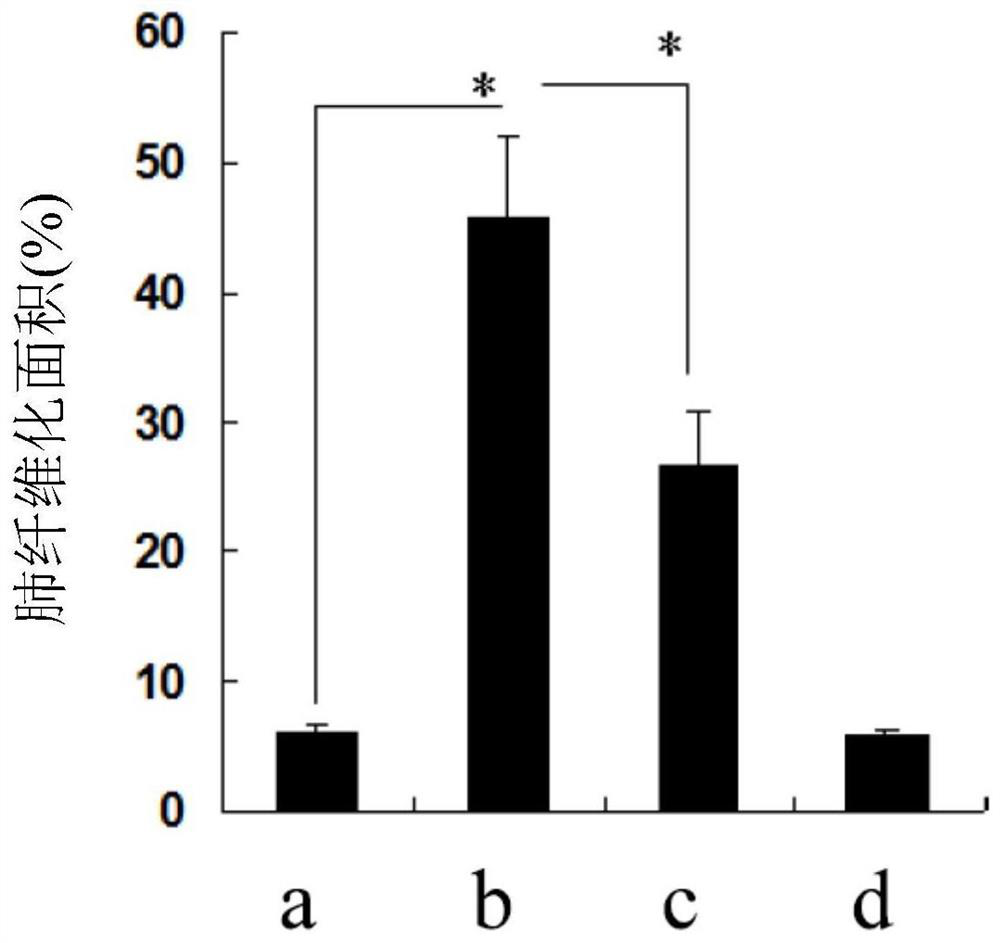 Application of Small Molecular Fucoidan in the Preparation of Medicines for Preventing Pneumonia Caused by Radiation