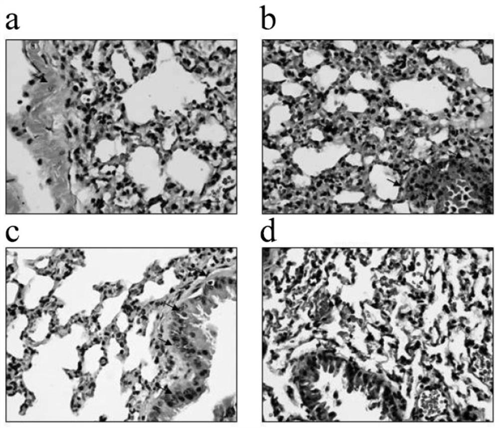 Application of Small Molecular Fucoidan in the Preparation of Medicines for Preventing Pneumonia Caused by Radiation