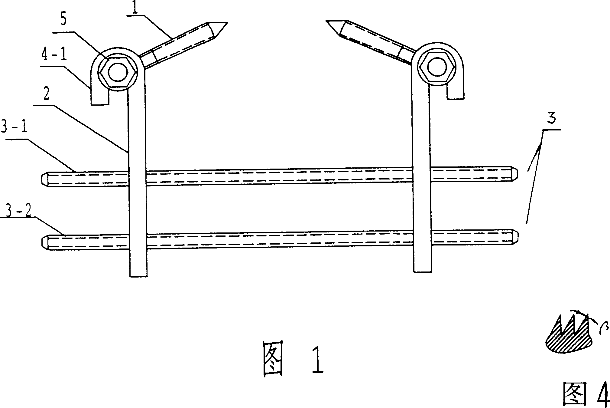 Pelvis and spinal column internal fixing device for treating lumbar vertebrae olisthy olisthe