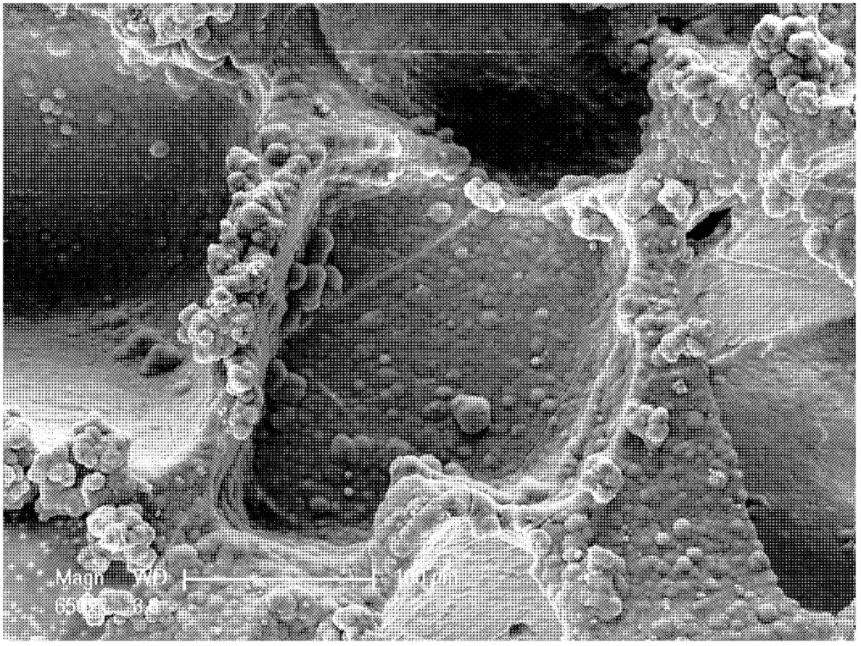 Inorganic bioactive material and method for preparing polymer porous composite material