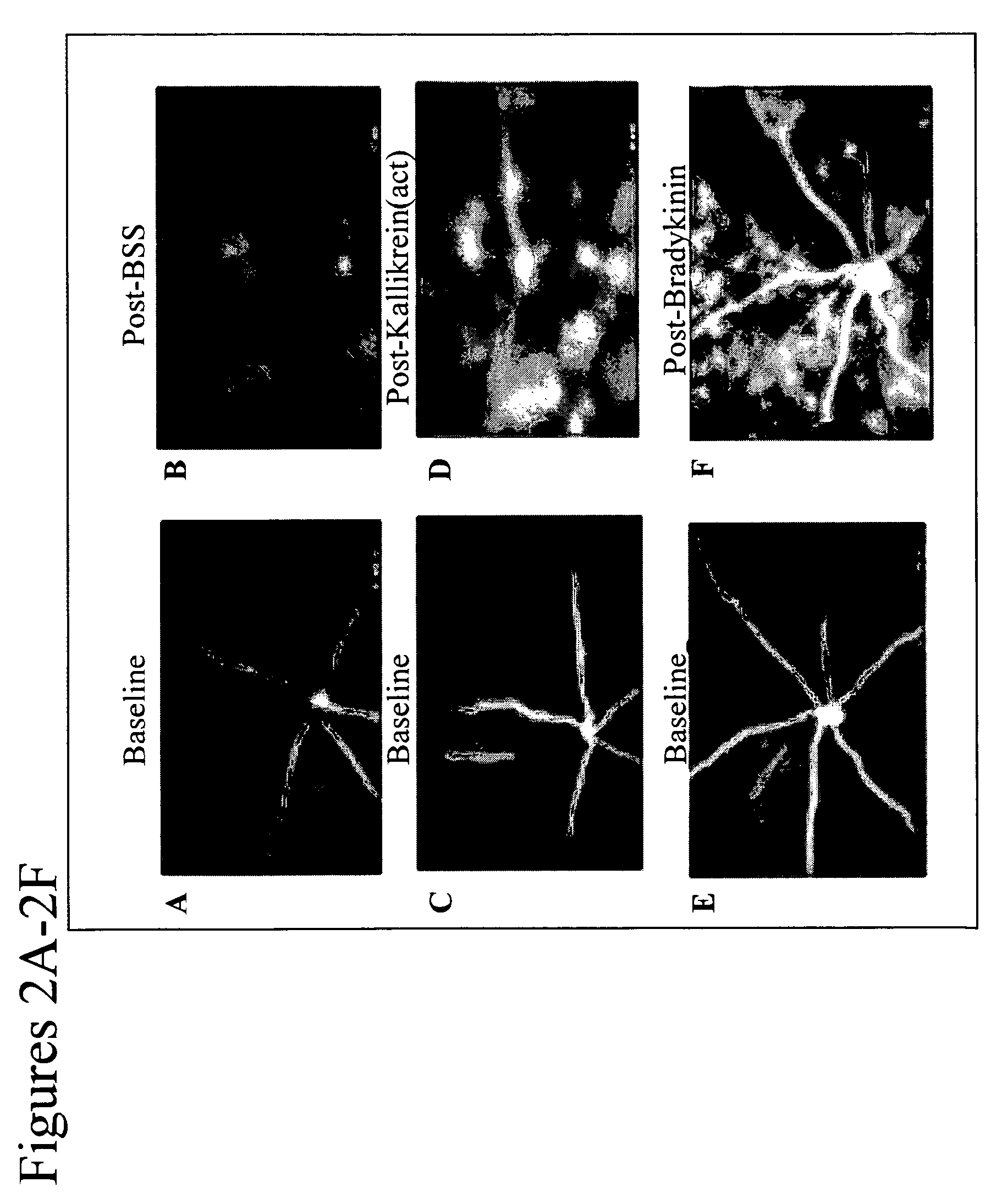 Methods for treatment of kallikrein-related disorders