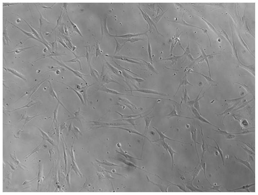 Method for efficiently and rapidly reprogramming somatic cells into neural stem cells and application thereof