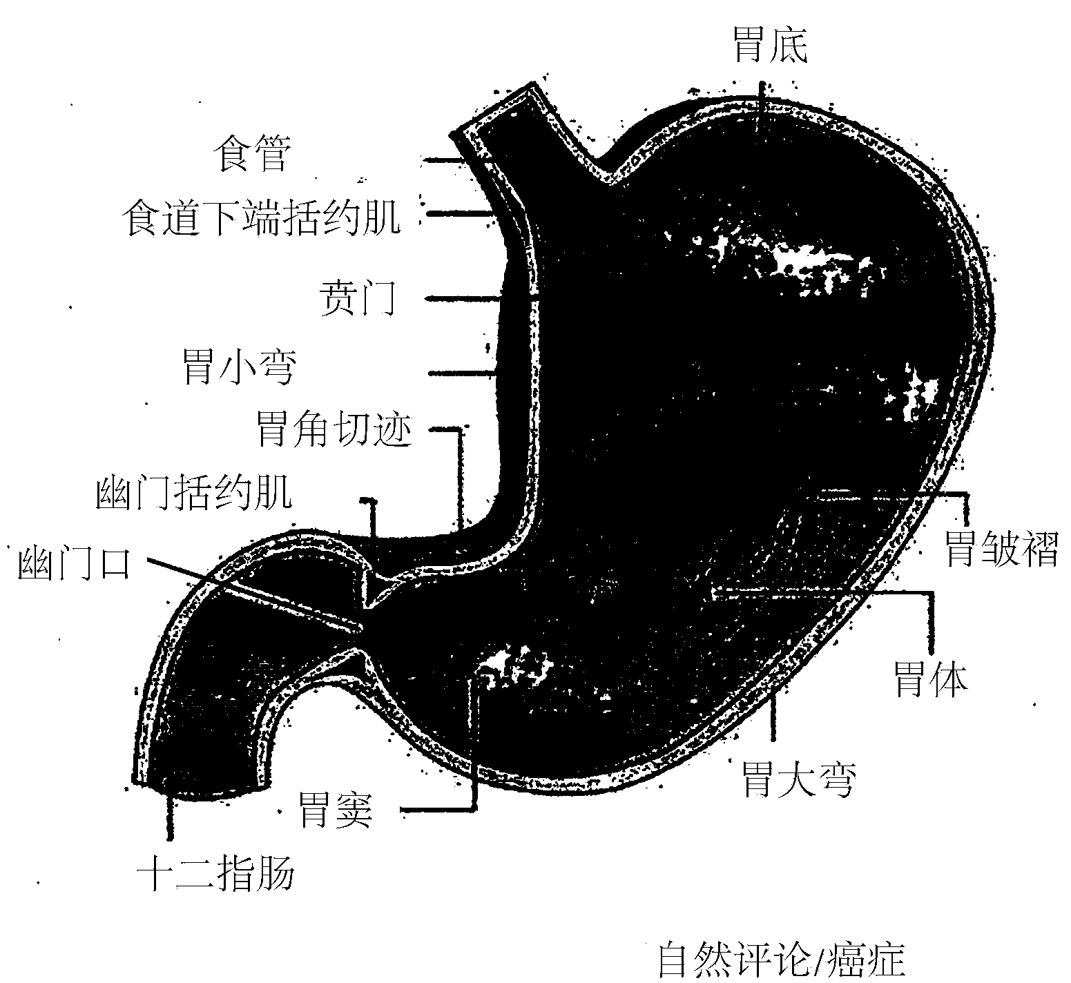 Anchoring and delivery system for a gastro-duodenal implant