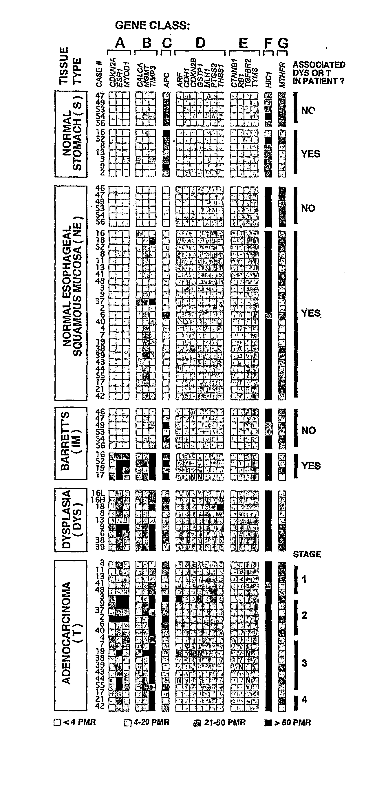 Epigenetic sequences for esophageal adenocarcinoma