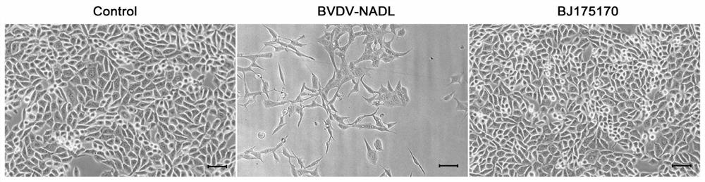 Bovine viral diarrhea virus BVDV-BJ175170 and application thereof