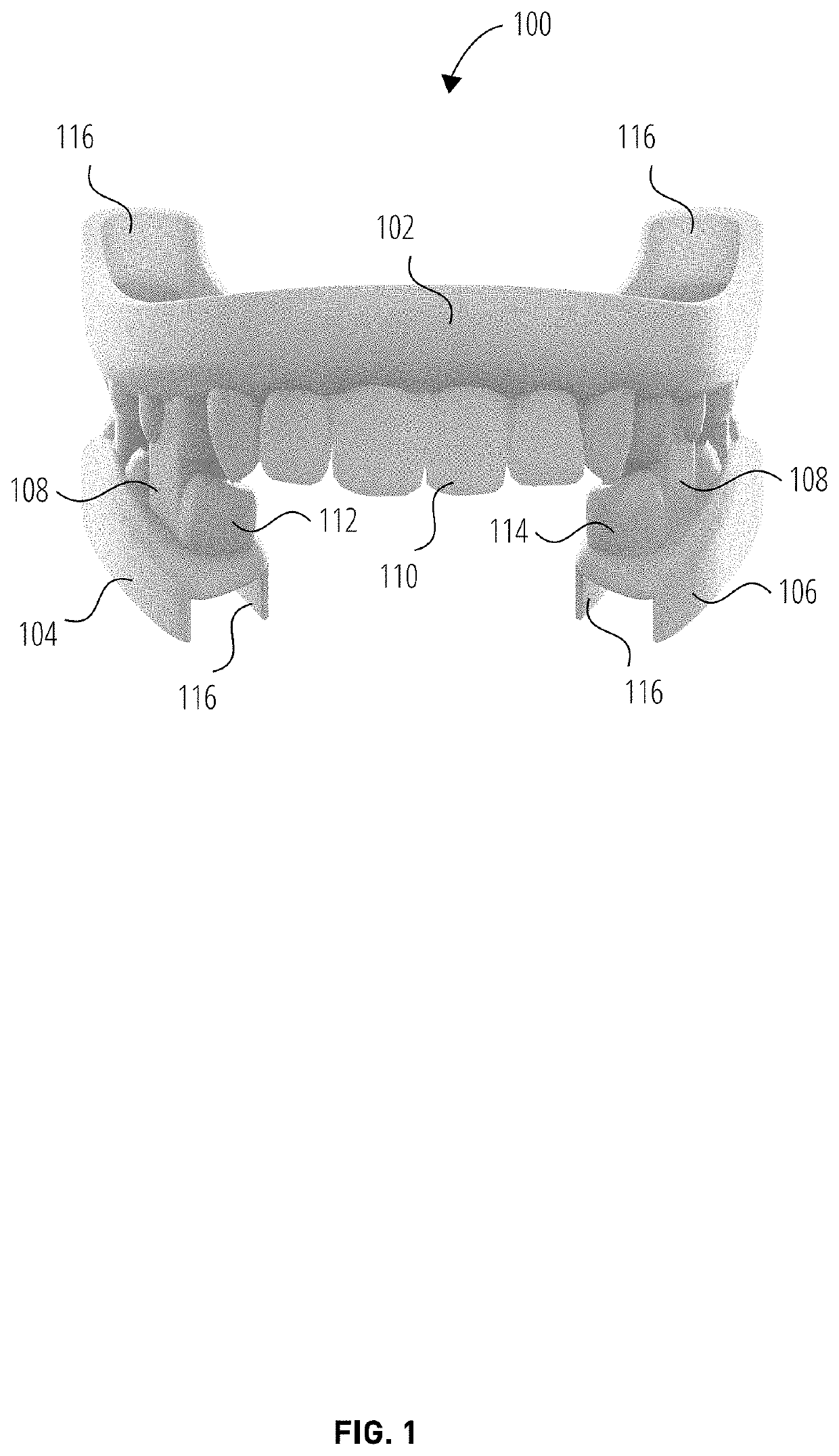 Protective athletic mouth guard