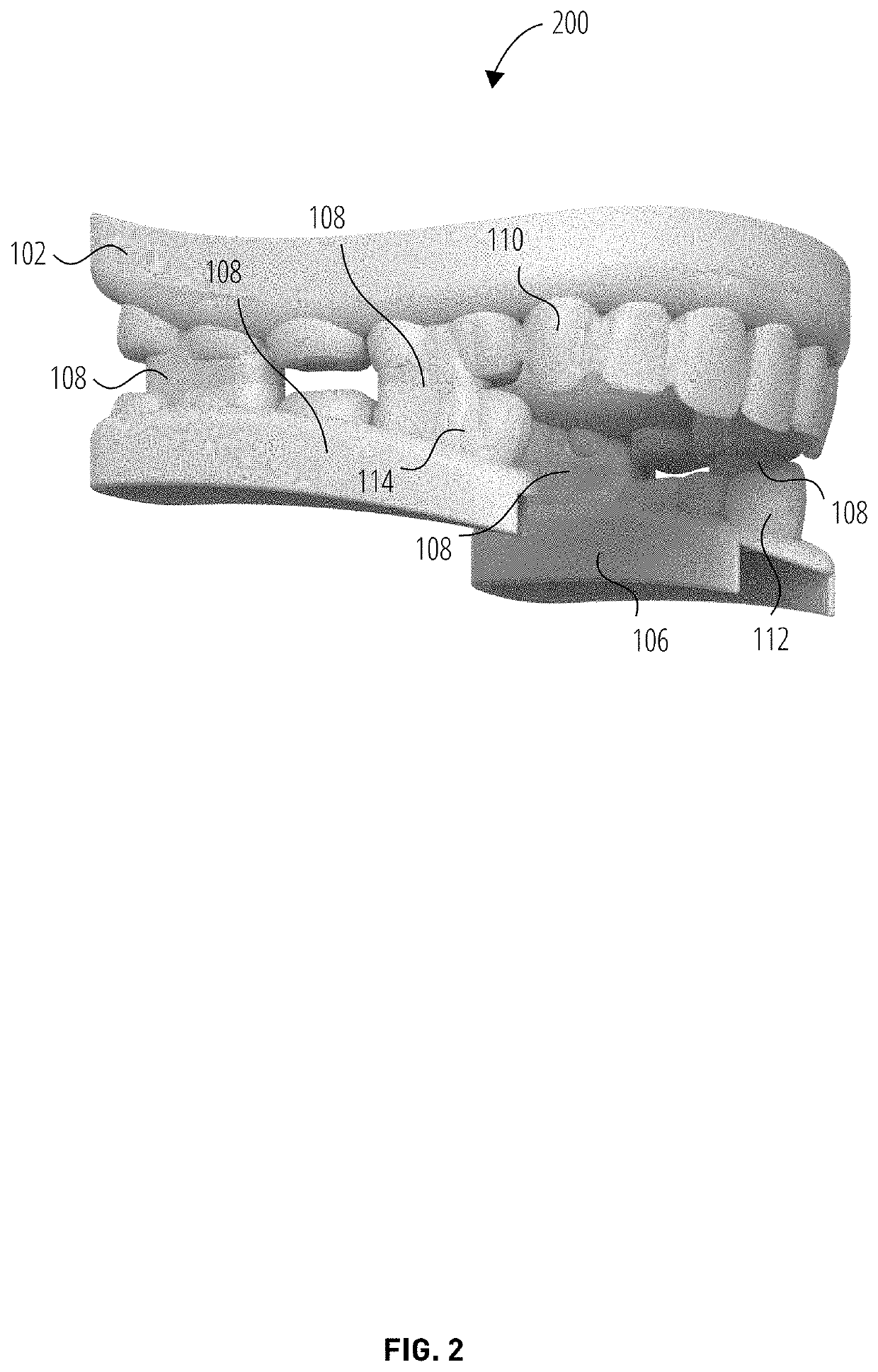 Protective athletic mouth guard