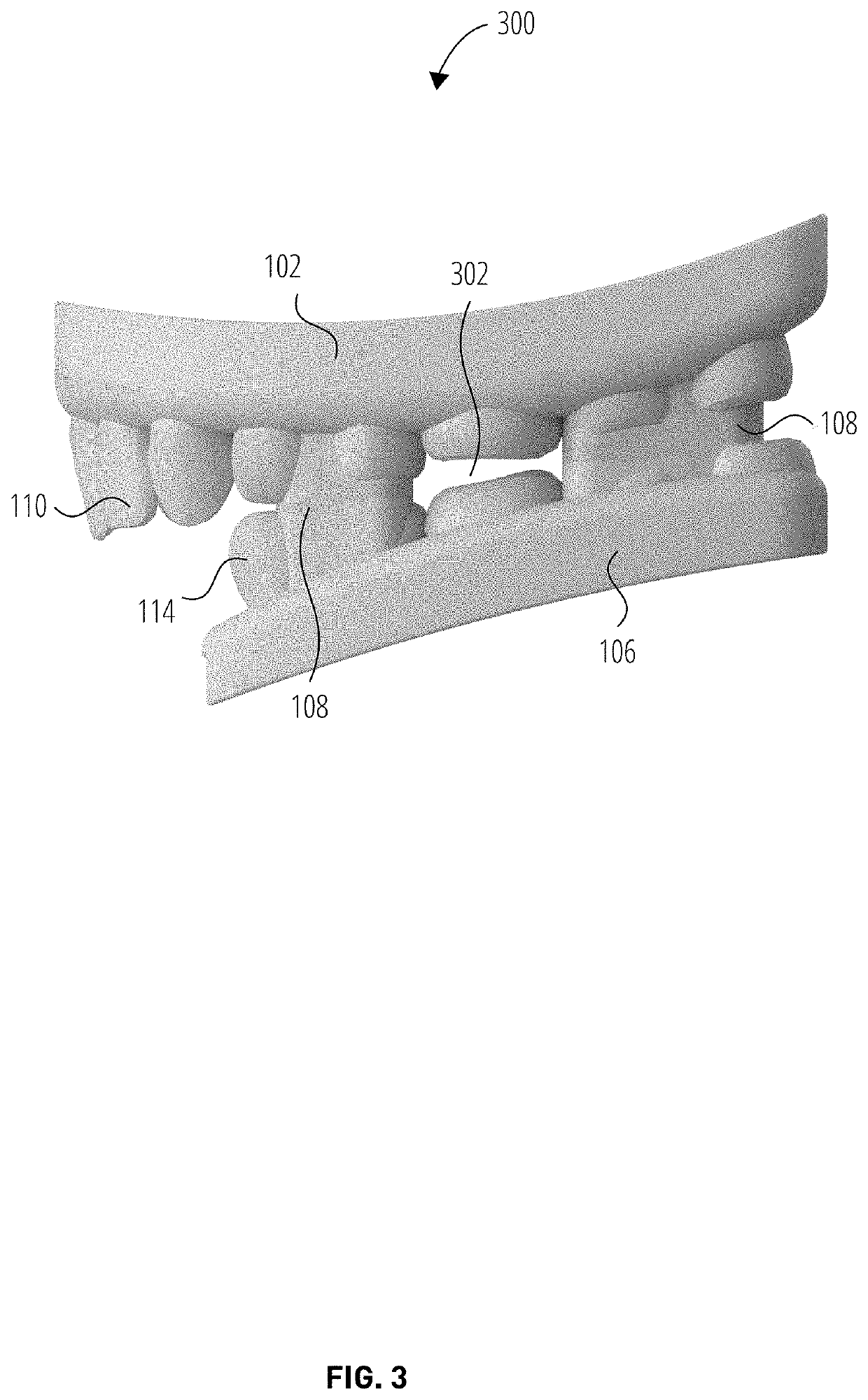 Protective athletic mouth guard