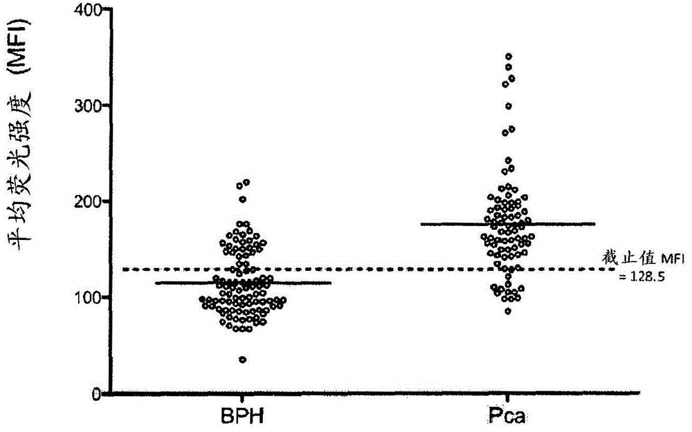 Method and kit for distinguishing between prostate carcinoma and benign prostatic hyperplasia