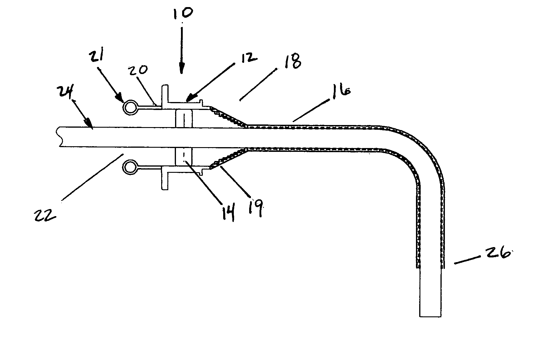 Expandable esophageal access device